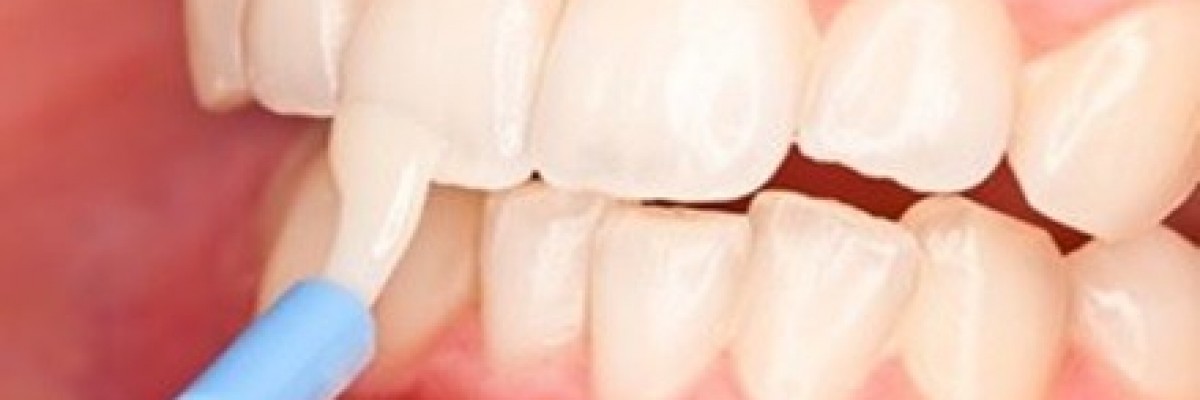Diş Sağlığı