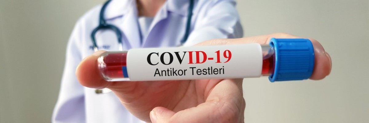 Covid-19 Aşısı Yaptırmadan Önce Antikor Testi Yaptırmak Gerekli Midir?