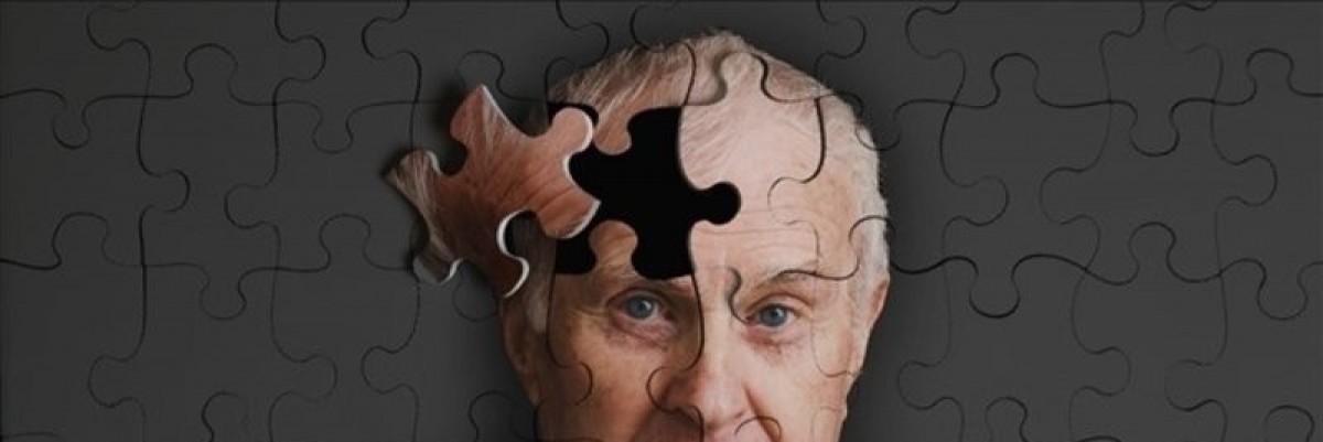 Demans ve Alzheimer 